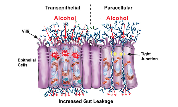 Graphic showing the intestinal barrier.