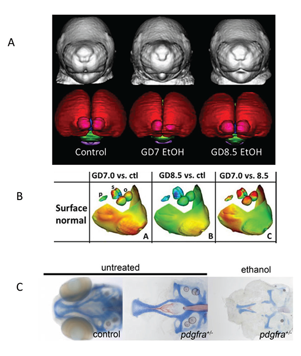 Magnetic resonance imaging (MRI) images showing the differential effect of different timing of exposure on face shape and brain morphology.