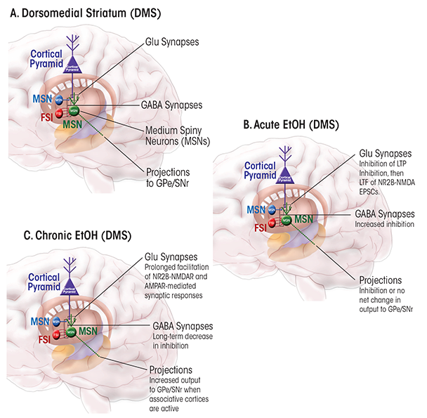 Schematic illustration of neuronal circuits in the dorsomedial striatum (DMS) and of the effects of acute and chronic ethanol exposure on plasticity in this region.