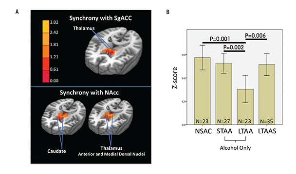 fMRI resting-state synchrony within the appetitive drive network is shown
