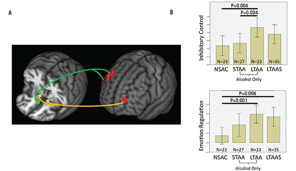 fMRI resting-state synchrony within the executive control network is shown.