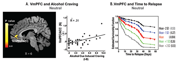 Hyperactive ventromedial prefrontal cortex (VmPFC) response to the neutral-relaxing condition, alcohol craving, and relapse risk.