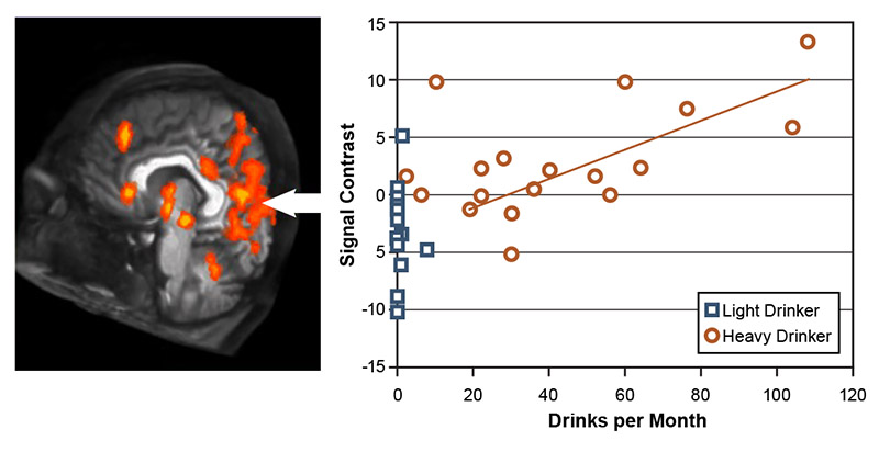 Figure 1 shows a scatter plot chart, which compares the brains of youth who drank heavily, represented on the chart by red circles, to the brains of youth who drank lightly, represented on the chart by blue squares. Next to the scatter plot is an image of a brain, taken by fMRI analyses, that show brighter areas, representing signal contrast, that are areas of the brain that were activated when youths, who were either categorized as those who drank heavily and those who drank lightly, were shown alcohol adv