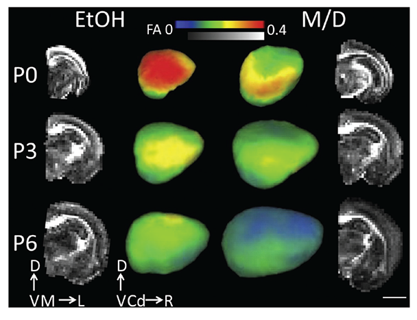 Effect of prenatal ethanol exposure on cerebral cortical fractional anisotropy