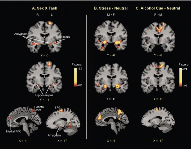 Average observed nonverbal behavioral and body responses to neutral, stress, and alcohol cue conditions by gender