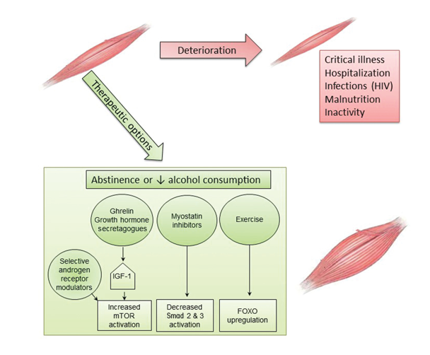 Graphic showing Aggravating conditions of, and therapeutic options for, alcoholic myopathy. Alcoholic myopathy may be further exacerbated by critical illness, prolonged hospitalization, chronic infection (e.g., HIV), malnutrition, and inactivity. Therapeutic options to achieve muscle mass accretion and restoration of skeletal muscle function include complete abstinence or at least decreased alcohol consumption, as well as aerobic exercise and/or resistance training. Other approaches currently being tested in myopathies of different etiologies also could prove effective for alcoholic myopathy. These include manipulation of the growth-hormone axis through administration of either insulin-like growth factor-1 (IGF-1), the principal mediator of growth-hormone action, or ghrelin, an upstream regulator of the growth hormone/mammalian target of rapamycin (mTOR) axis. Inhibition of myostatin, a negative regulator of muscle growth, may reduce Smad signaling, thereby preventing loss of muscle mass. Finally, exercise may lead to upregulation of Forkhead box protein O1 (FOXO1). Further studies are needed to determine the efficacy of these therapies for amelioration of alcoholic myopathy.