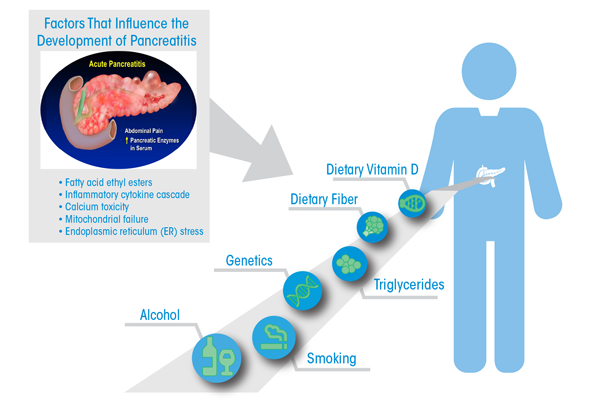 Graphic showing The figure emphasizes the association of alcohol abuse, smoking, high triglycerides, and specific genetic mutations in promoting pancreatic disease. Dietary fiber and vitamin D are associated with protection from pancreatitis. The insert in the upper-left aspect of the figure shows the factors in the pancreatic tissue that are involved in the mechanisms of pancreatitis development.