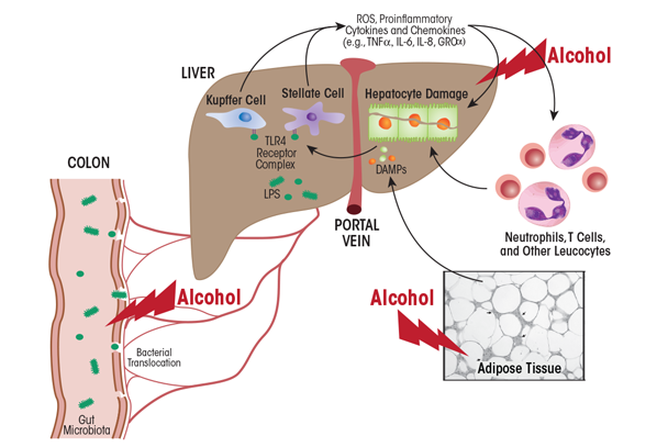 Graphic showing The gut–liver axis. A major factor in the initiation of the inflammatory response by resident macrophages of the liver (i.e., Kupffer cells) is endotoxin or lipopolysaccharide (LPS), a cell-wall component of Gram-negative bacteria that translocates from the gut lumen into the portal circulation to reach the liver. Enhanced circulating endotoxin levels in alcoholic hepatitis are caused by alcohol-induced qualitative and quantitative changes in the bacteria that inhabit the gut (i.e., gut microbiota) and increased gut leakiness. In the liver, LPS activates Kupffer cells and hepatic stellate cells by interacting with toll-like receptor 4 (TLR4). These cells produce reactive oxygen species (ROS) as well as proinflammatory cytokines and chemokines that together with alcohol contribute to hepatocyte damage. Other factors contributing to hepatocyte damage include alcohol-induced activation of various immune cells (i.e., neutrophils, T cells, and other leukocytes) as well as alcohol’s effects on the fat (i.e., adipose) tissue, which results in the production of damage-associated molecular pattern (DAMP) molecules.