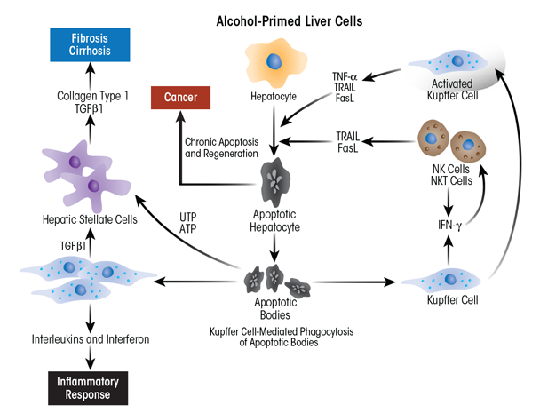 Graphic showing Schematic depiction of the role of Kupffer cells (KCs) and hepatic stellate cells (HSCs) in promoting alcohol-induced inflammatory changes and progression to fibrosis and cirrhosis. Injury begins with alcohol-induced hepatocyte damage and death (apoptosis), which generates apoptotic bodies that stimulate KCs to secrete inflammatory factors, such as tumor necrosis factor alpha (TNFα), interferon gamma (IFN-γ), tumor necrosis factor-related apoptosis-inducing ligand (TRAIL), and Fas ligand (FasL). These factors attract immune cells (e.g., natural killer [NK] cells and natural killer T cells [NKT cells]) to the liver to exacerbate the inflammatory process. Activated HSCs secrete abundant extracellular matrix proteins (e.g., collagen type 1), forming scar tissue (fibrosis) that can progress to cirrhosis. In this condition, the scar tissue forms bands throughout the liver, destroying the liver’s internal structure and impairing the liver’s ability to regenerate itself and to function.