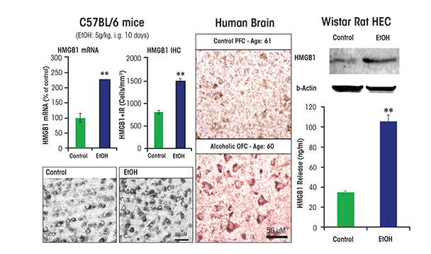 Alcohol increases high-mobility group box 1 (HMGB1) expression in mouse brain, and human brain and induces HMGB1 release from rat brain slices. (Left) Chronic ethanol treatment of mice for 10 days increases expression of HMGB1 mRNA and protein. (Middle) Postmortem human alcoholic orbitofrontal cortex (OFC) has significantly more HMGB1-immunoreactive cells than seen in age-matched moderately drinking control subjects. (Right) Ethanol causes the release of HMGB1 into the media from hippocampal-entorhinal cortex (HEC) slice culture.