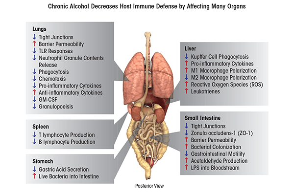 Chronic alcohol exposure causes immune dysfunction through effects on multiple organs. In the lungs, excessive inflammation causes tissue damage, increasing barrier permeability, and dampening many cellular immune responses, such as recognizing bacteria (through toll-like receptors [TLRs]), attacking pathogens (through phagocytosis), decreasing production of granulocytes (i.e., granulocytopenia) as well as their migration (i.e., chemotaxis), and altering important signaling and recruiting molecules (e.g., G