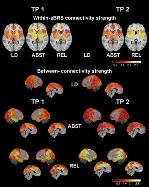 Within-network and between-networks gray matter connectivity.